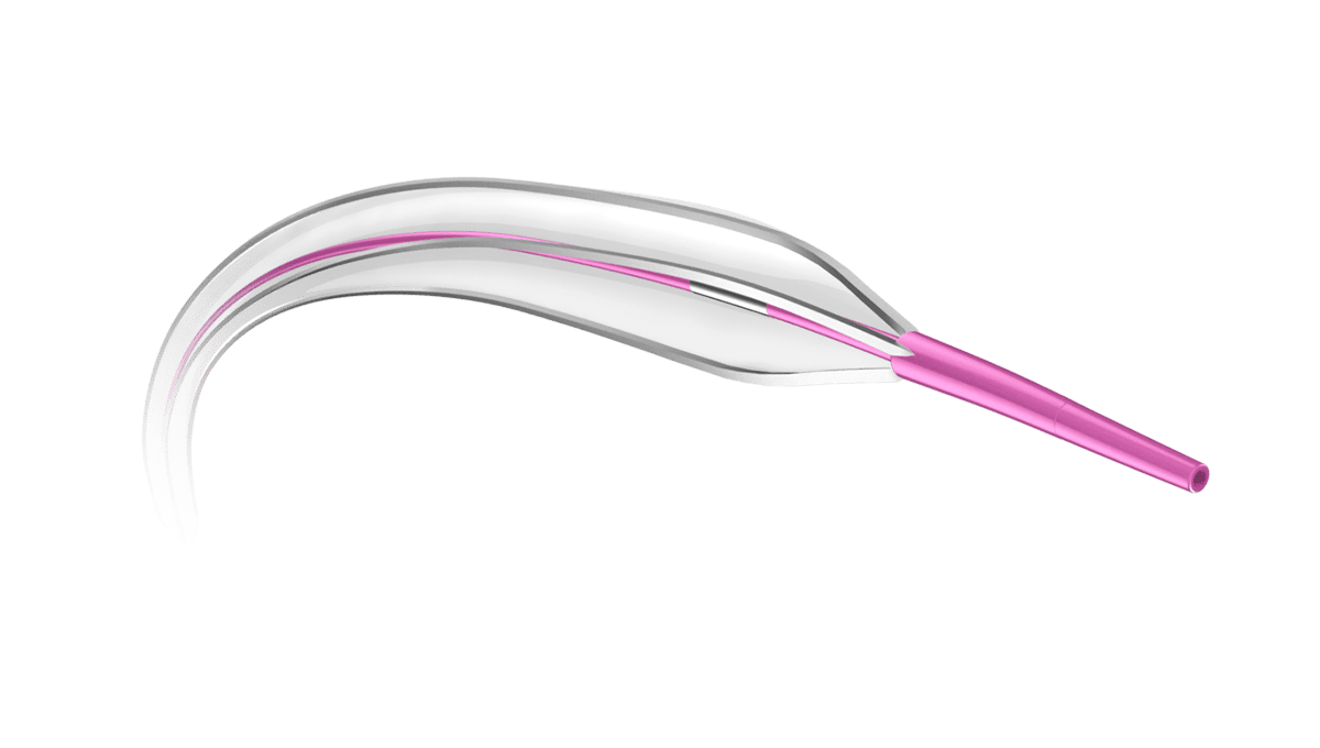 Tri-Wedge
